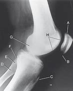 Image result for Normal Lateral Knee Radiograph