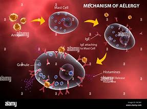 Image result for Post Pico Genesis Histamine Reaction