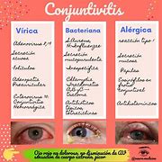 Image result for Conjuntivitis