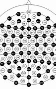 Image result for tDCS Placement Map