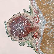 Image result for Soybean Nodule