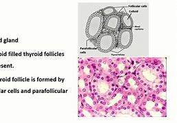 Image result for Parafollicular Cells Histology