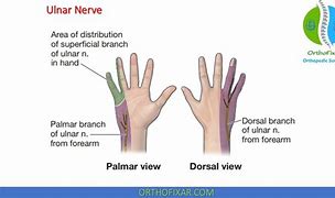 Image result for Hand Nerve Innervation