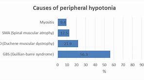 Image result for Central and Peripheral Hypotonia