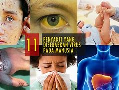 Image result for Penyakit Yang Disebabkan Oleh Vibrio