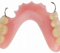 Image result for Acrylic Denture with Wrought Wire Clasps