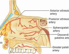 Image result for Retrocaval Artery