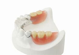 Image result for Partial Plate Dentures