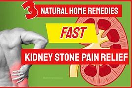 Image result for Kidney Stone Remedy