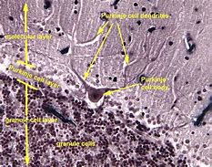 Image result for Brain Tissue Histology