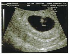 Image result for 6 Week HD Ultrasound