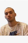 Image result for Adin Ross Balding