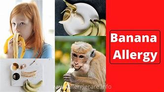 Image result for Banana Allergy Meme