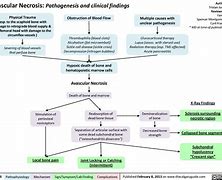 Image result for Avascular Necrosis Pathology