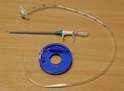 Image result for PEG Tube Replacement