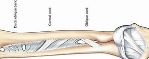 Image result for Interosseous Ligament