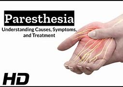 Image result for Acral Paresthesias