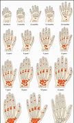 Image result for Bone Age Hand X-ray