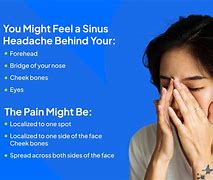 Image result for Sinus Cheek Pain