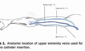 Image result for Midline Example