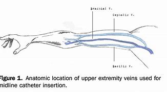 Image result for Midline Trig