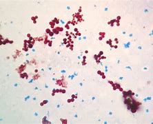 Image result for Mycobacterium in Fish