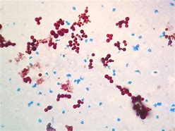 Image result for Mycobacterium Piscium Fish