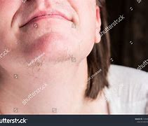 Image result for Female Hair On Chin