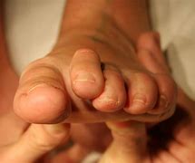 Image result for Greyhound Dislocated Toe