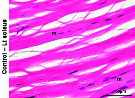 Image result for Micro Tears in Muscle Fiber Under Microscopes