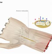 Image result for Dorsal Aspect Wrist