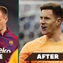 Image result for Ter Stegen Hair Transplant