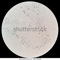 Image result for Muco Urine