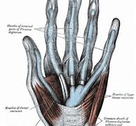 Image result for Palmar Bowing of the Flexor Retinaculum