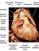 Image result for Posterior Interventricular Sulcus