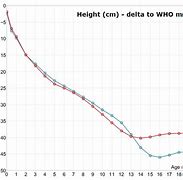 Image result for Achondroplasia Height Chart