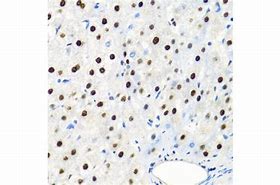 Image result for SSB Antibody