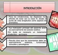 Image result for Tipos De Maloclusion