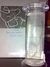 Image result for Dracunculus Nematode