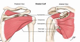 Image result for Supraspinatus and Infraspinatus Tendinopathy