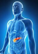 Image result for Pancreatic Cancer