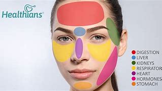 Image result for Acne Boy Face Map