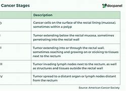 Image result for Adenocarcinoma Rectal Cancer