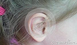 Image result for Girl Ear Lobe