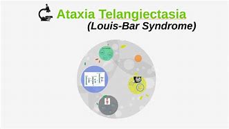 Image result for Louis Bar Syndrome