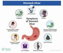 Image result for Ulcer Stomach Actual Photo