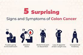 Image result for Colon Cancer Early Symptoms