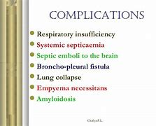 Image result for Thoracic Empyema On Percussion