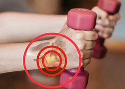 Image result for Outer Wrist Pain