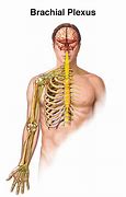 Image result for Brachial Plexus Injury